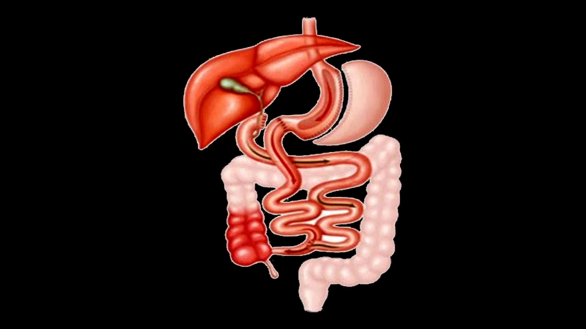 Esquema del cruce duodenal: estómago en forma de tubo, unido a la última parte del intestino delgado
