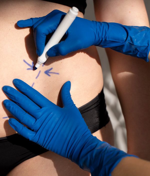 Cirugía-Bariátrica-Madrid