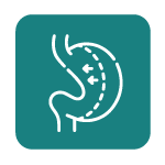 Icono-Cirugía-Baríatrica