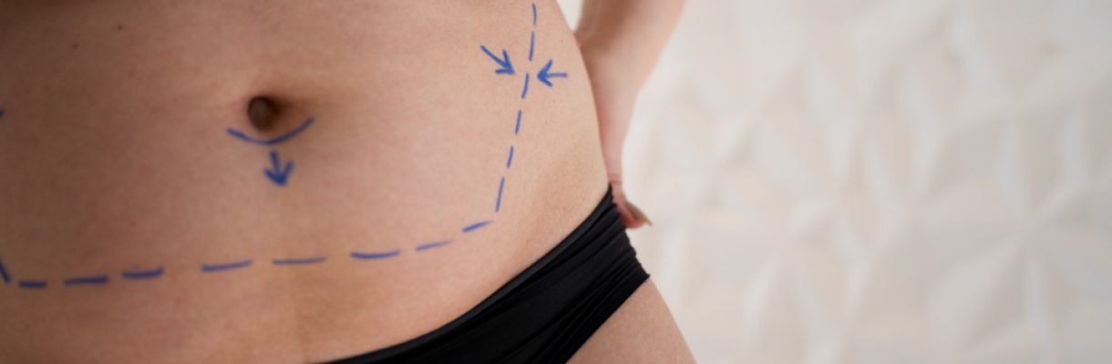 Imagen-Bariátrica-1