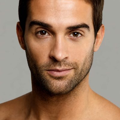 masculinizacion facial 6